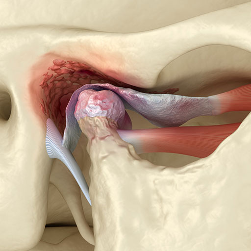 Articulación Temporomandibular